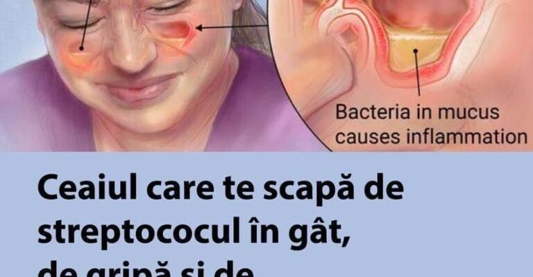Ceaiul care te scapă de streptococul în gât, gripă și infecțiile sinusurilor