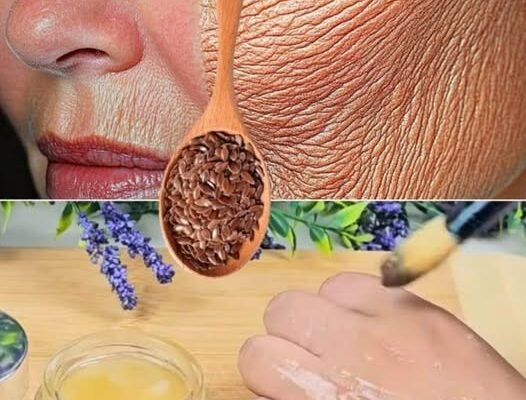 Chiar și la 70 de ani, dacă folosești asta pe riduri, îți va face pielea netedă ca sticla. Botox mai puternic!