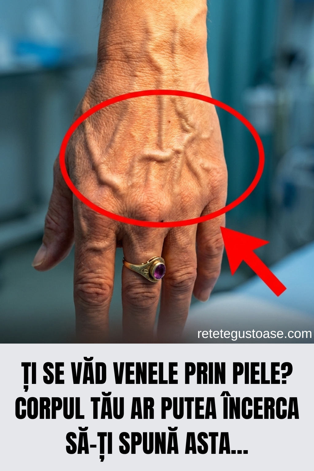 Ți se văd venele prin piele? Corpul tău ar putea încerca să-ți spună ASTA…