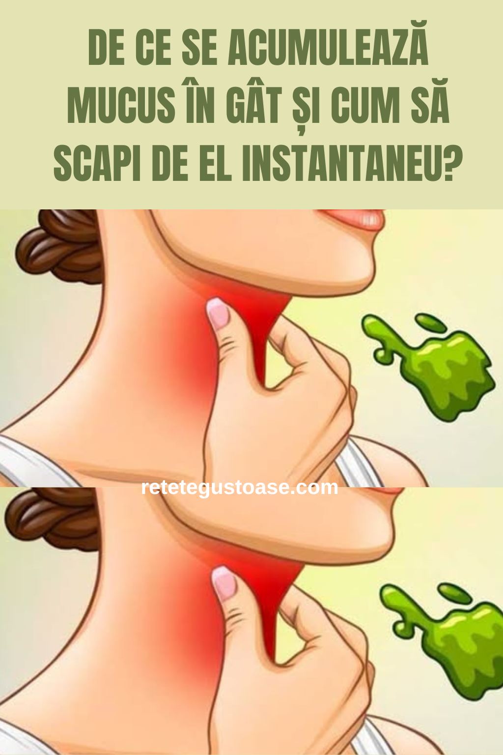 De ce se acumulează mucus în gât și cum să scapi de el instantaneu?