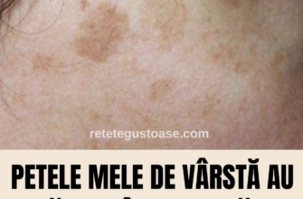 Petele mele de vârstă au DISPĂRUT când am adăugat aceste 4 alimente simple în dieta mea.