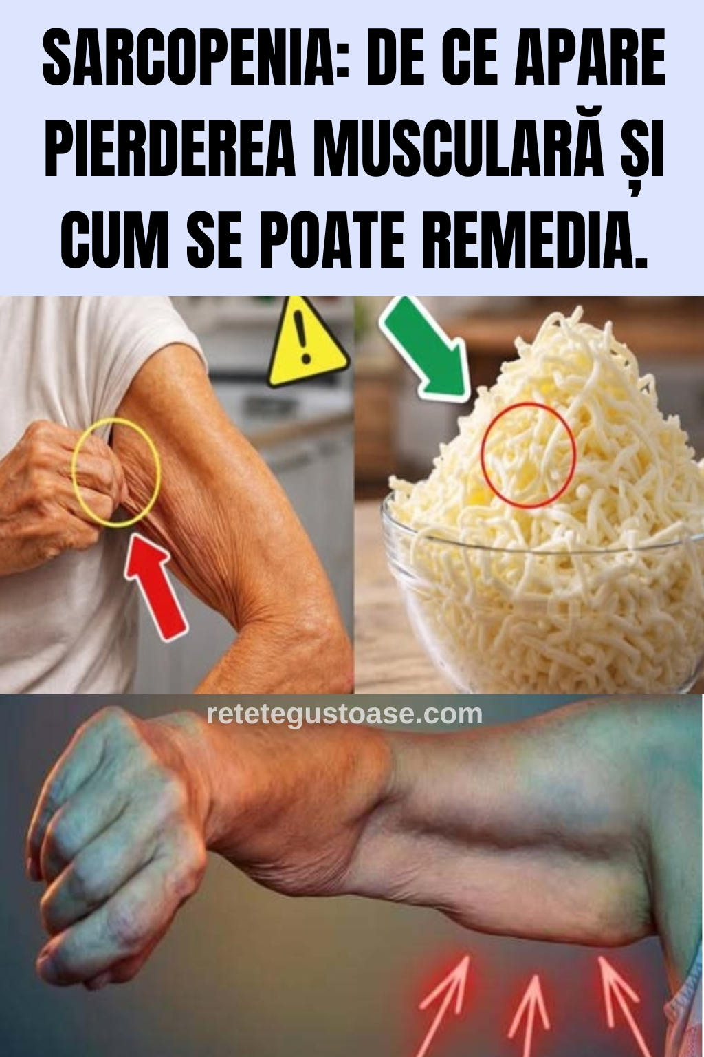 Sarcopenia: De ce apare pierderea musculară și cum se poate remedia.
