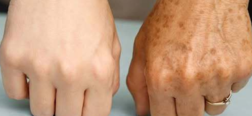 Cremă de mâini rejuvenantă, preparată în casă: o rețetă care elimină petele și ridurile de pe piele după a treia utilizare. Mâini sub 15 ani