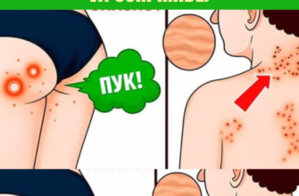 Ciroză hepatică: 4 simptome alarmante pe care nu ar trebui să le ignorați (#3 vă va surprinde)