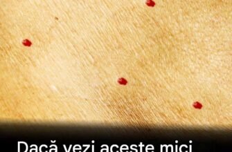 Puncte roșii pe piele: cauze și ce ar putea însemna